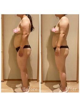 オクノマ(OKUNOMA)/【全身美背骨BeforeAfter】