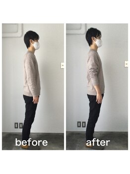 美容整体プラスフィール 恵比寿本店/姿勢矯正・猫背改善