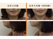 ビューティフィーサロン ベルル(Belulu)/たるみ改善／期待できる効果