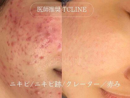 トップスキン 名駅(TOPSKIN)の写真
