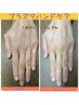  【年齢を感じさせない手指へ】贅沢ハンドエステ(ハンドマッサージ付) 