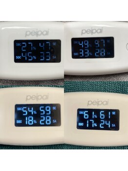 アデージョ アデオス(Ade-jyo.Adeosu)/肌診断結果が戻らない