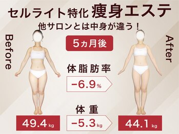 ラ パルレ 梅田本店/全身引き締めセルライトケア