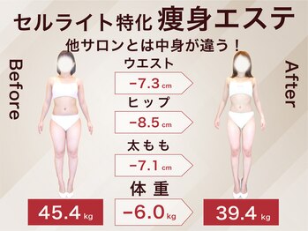 ラ パルレ 富山店/全身セルライトケア