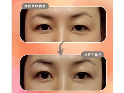 ソヨリプラス(Soyory Plus)の写真