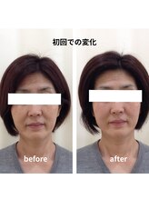 かがりの整骨院 鍼灸院/鍼灸/美容鍼/小顔