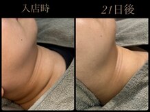 ビーエルティー(blt)/レモンボトル