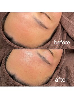 ムート(Mut.)/眉毛と一緒にフェイスワックス