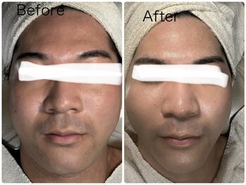 ルミネル 名古屋新栄(Luminelle)/小顔矯正