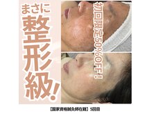 エトワール(etoile)の雰囲気（【くすみ・しわ改善】美容鍼 × 組み合わせ施術でシミケア）