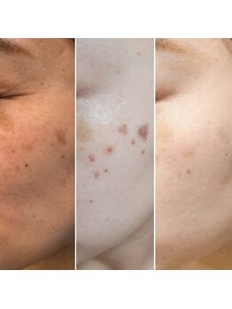 アルディート(Ardito)の写真/肌悩みに合わせて、理想の素肌へ。