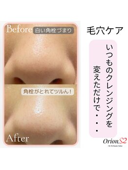 オリオンドットエスツー(Orion.S2)/【Before→After】