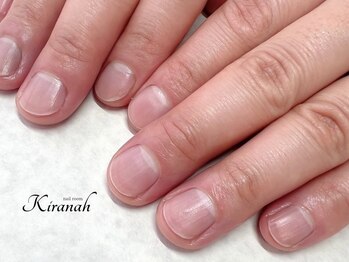 キラナ 恵比寿(Kiranah)の写真/【自爪育成ケア/保湿マッサージ+手先スクラブ付き¥4,500(新規)】手荒れや乾燥にお悩みの方必見！[恵比寿]