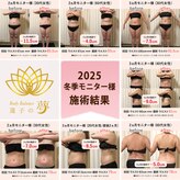 蓮子の夢
