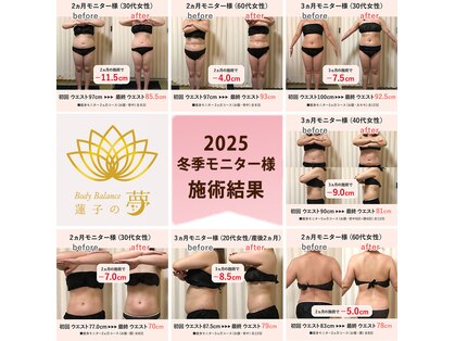 蓮子の夢の写真
