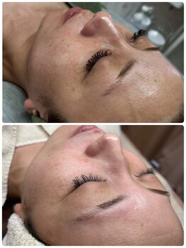 シロエルヴィ(SILOE)/未来の自分に、胸が高まる。