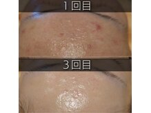 エッセンシア(ESSENCIA)の雰囲気(高濃度ヒト幹細胞美容液導入で、年齢を感じさせない艶肌へ!)