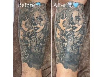 ココカナ(COCOKANA)/Tattooがあってもwax脱毛なら◎