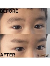 アイブロウマン(i Browman)/施術イメージ