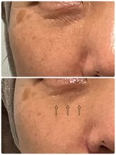 ソラウミ(SORAUMI)/セルマンの効果☆