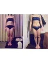 パーフェクトボディプレミアム 渋谷店(PERFECT BODY PREMIUM)/お客様　ビフォーアフター（11）