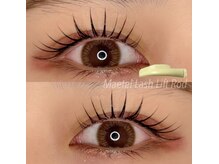 ループラス(r'oo plus)/メーテルeye