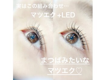 ヴィクトリア アイ(victoriaeye)