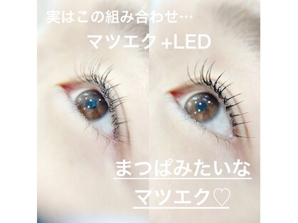 ヴィクトリア アイ(victoriaeye)の写真