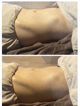 ヴァローレ(valore)/お腹の張り/ガス溜り