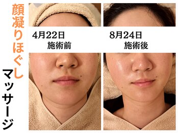 エリン(ERIN)/顔ほぐしマッサージ