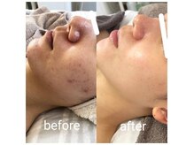 お悩みに合ったトリートメントで最短の改善方法をご提案します