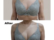 リヴェーヌ 富山店の雰囲気（バストアップもお任せ！形の改善やバランスの形成も対応します♪）