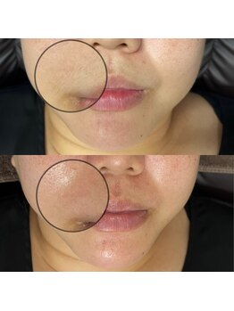 シェリー トウキョウ 西葛西店(Cherie Tokyo)/肌に低刺激なワックス脱毛◎