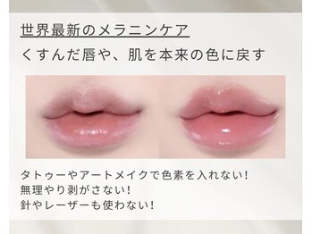 ココノワ(coconoix)/ローマピンク唇