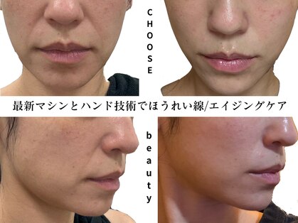 アイチューズ(ICHOOSE)の写真