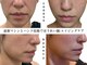 アイチューズ(ICHOOSE)の写真