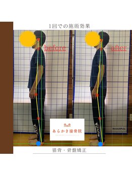 あらかき接骨院/【姿勢の変化】