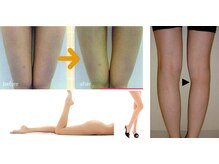 センティア アピタ岩倉店/痩身・ボディ