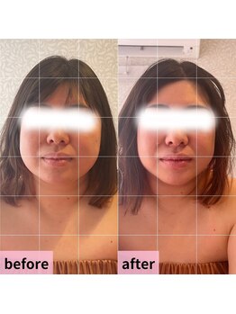 ビューティースタジオ エイワン(A1)/