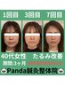 【7月残り2名】周りに差をつける美容鍼 たるみ改善美肌コース 初回体験¥5980