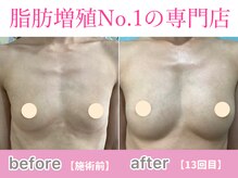 サラエクセレント 新宿(SARA EXCELLENT)/デコルテからバストアップ！