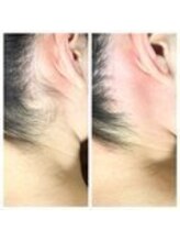 ヴァージンワックスプラス 銀座店(Virgin Wax +)/人気のシュガーリング脱毛も♪