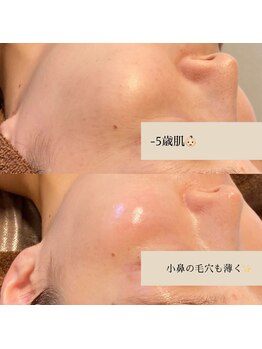 ひっそり美肌構築/赤ちゃんのようなお肌へ♪