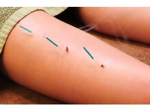 ヒーリングゆうの雰囲気（鍼灸、アロママッサージ、整体など様々なメニューがございます♪）