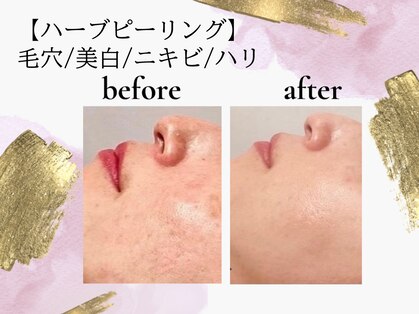 エステサロン プラスエー(+A)の写真