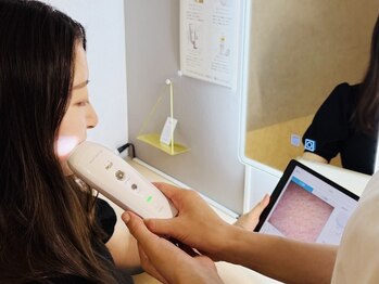 シロ(CHILO)/肌診断でお肌の状態をチェック☆