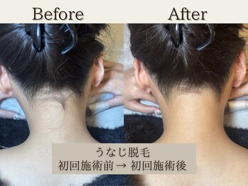 インベスト(INVEST)/うなじ♪