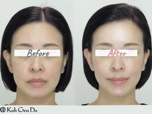 江原道 銀座サロン(Koh Gen Do)