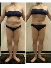 ヴィオテラス(VIOTERACE)/２ヶ月ダイエット☆