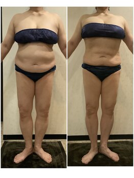 ヴィオテラス(VIOTERACE)/２ヶ月ダイエット☆